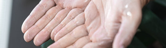 How Common is Hyperhidrosis?